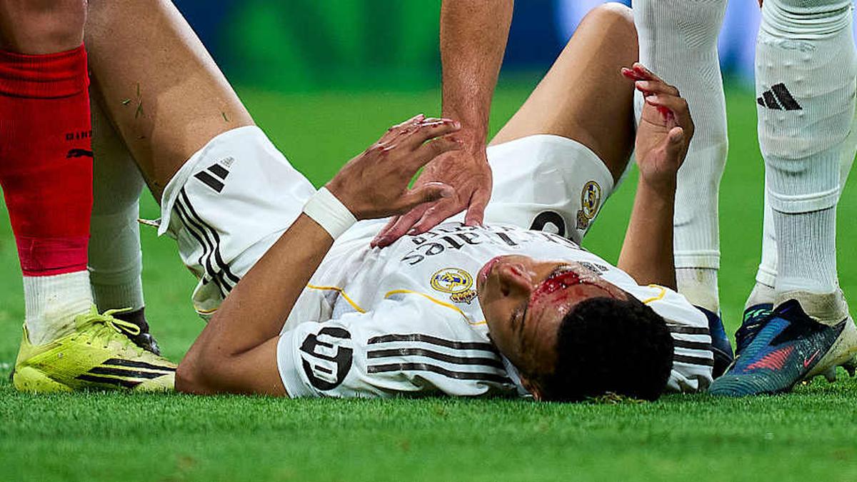  Mbappé suffered a gruesome-looking injury against Girona but did not receive a penalty. | Diego Souto/Getty Images 