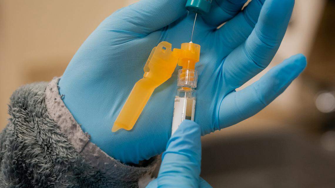 What makes measles cases an outbreak? California reports first since 2020