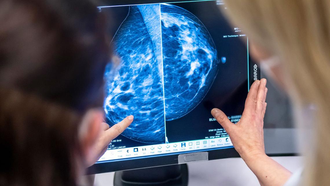 Six avoidable factors that increase your risk of breast cancer