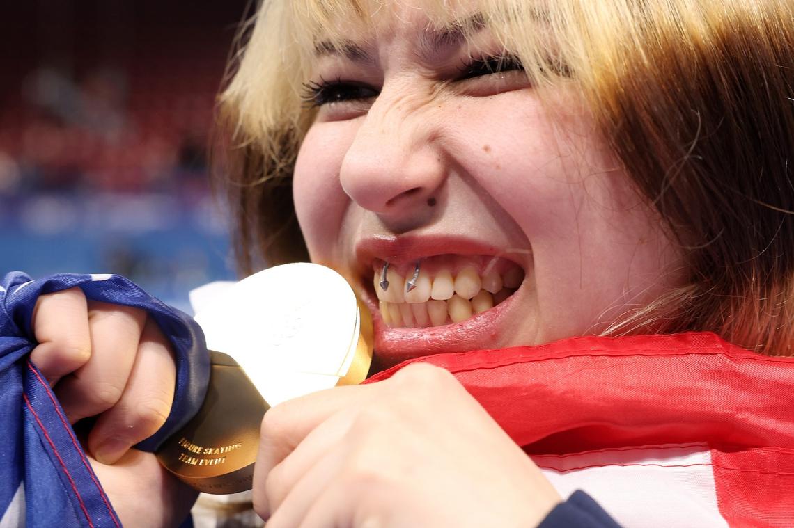  Alyssa Liu has a frenulum piercing.Jamie Squire/Getty Images 