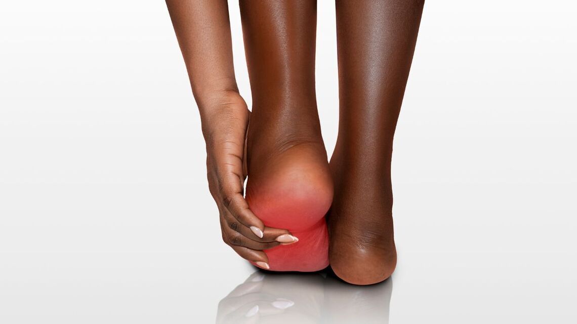 Worried Your Tingly Feet Are a Sign of MS? Why It May Really Be Low B12