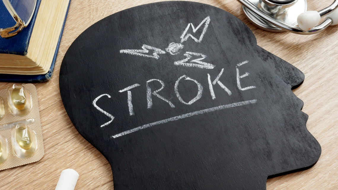 Experts uncover potential cause of common type of stroke