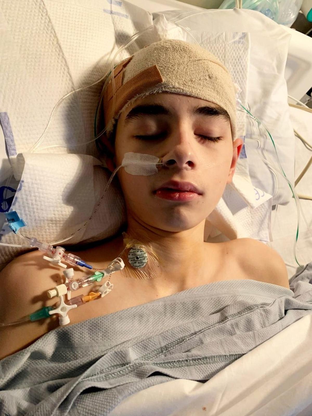  Alex Costa-Veiga, 16, recovering from surgery. (Brain Tumour Research via SWNS) 