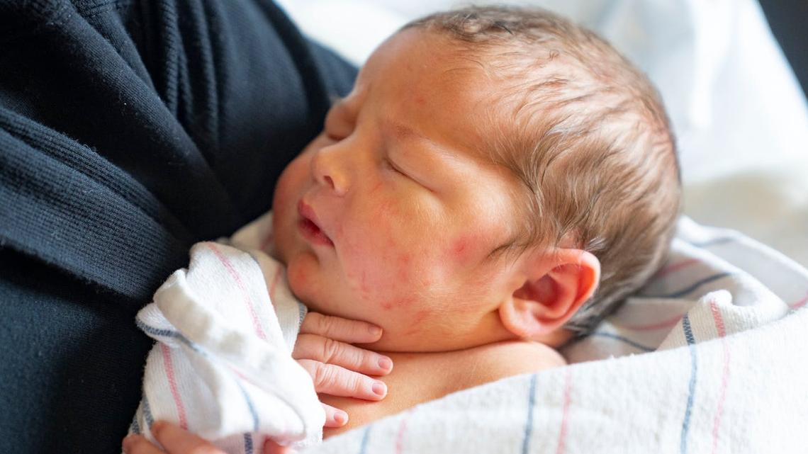 Jill Burcum: A newborn care delay that could be deadly 