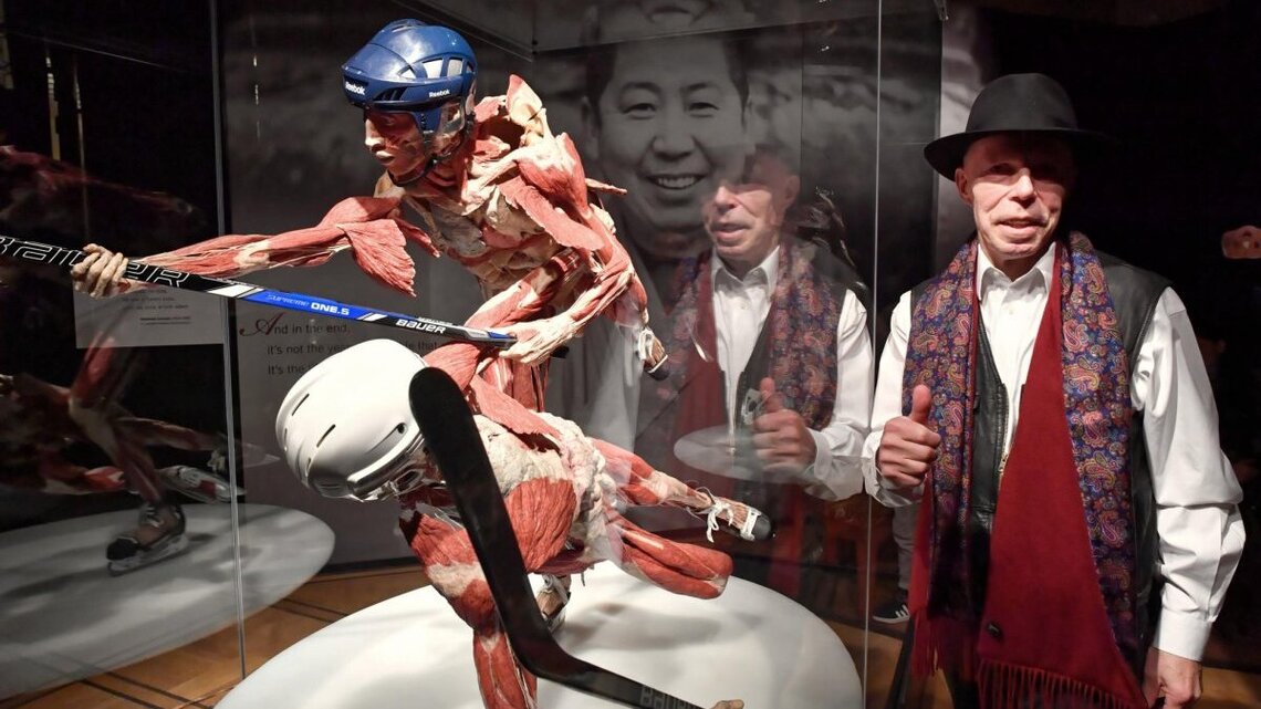 Gunther Von Hagens, inventor of ‘Body Worlds’ exhibits, dies at 81