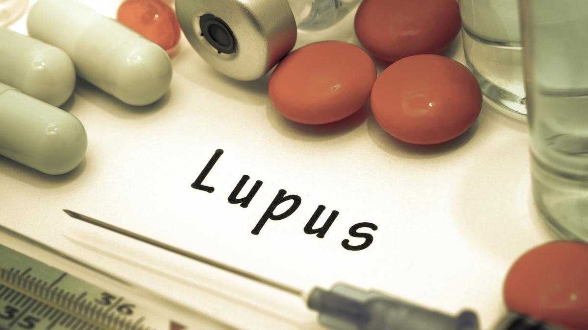 Lupus is more common in women — particularly between the ages of 15 and 45 — but it can occur at any age. (Natal'ya Buzuevskaya/Dreamstime/TNS)