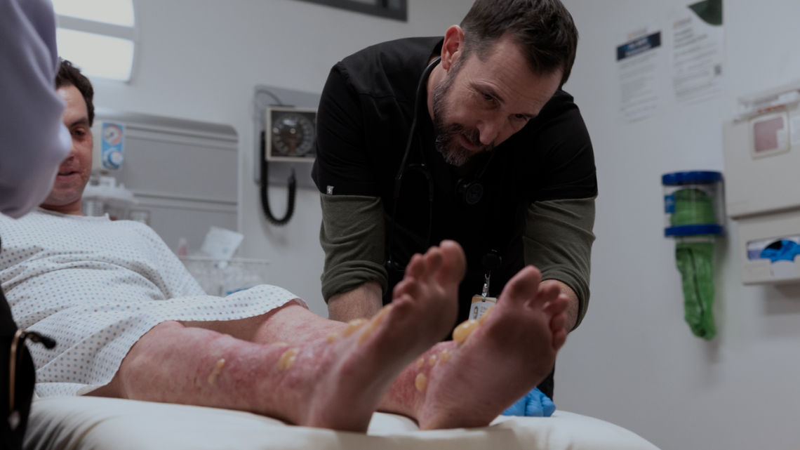 'The Pitt': What Is a Margarita Burn? Phytophotodermatitis, Explained 