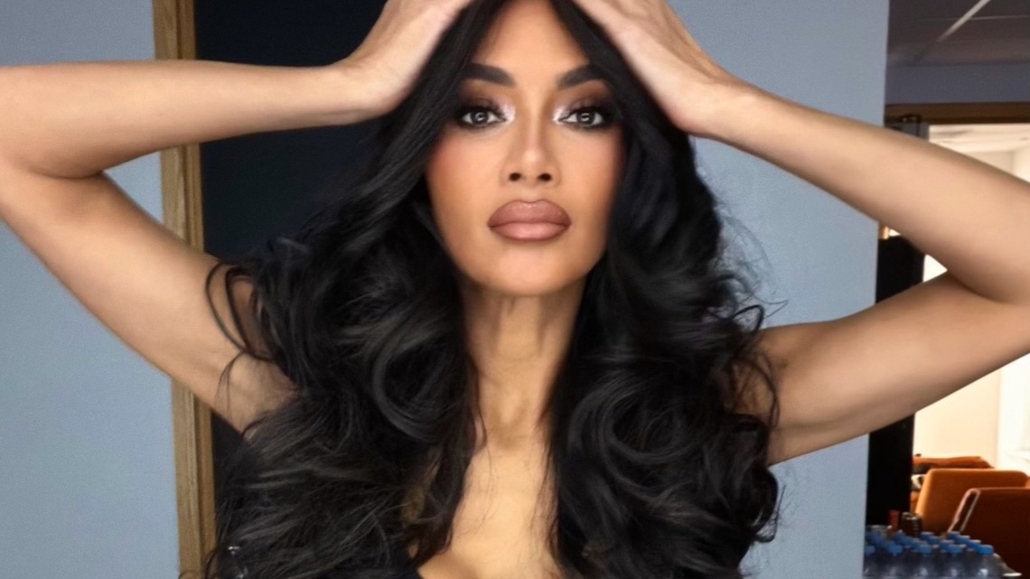 Nicole Scherzinger Shares Update After Suffering Gnarly Boiling Water Burn 
