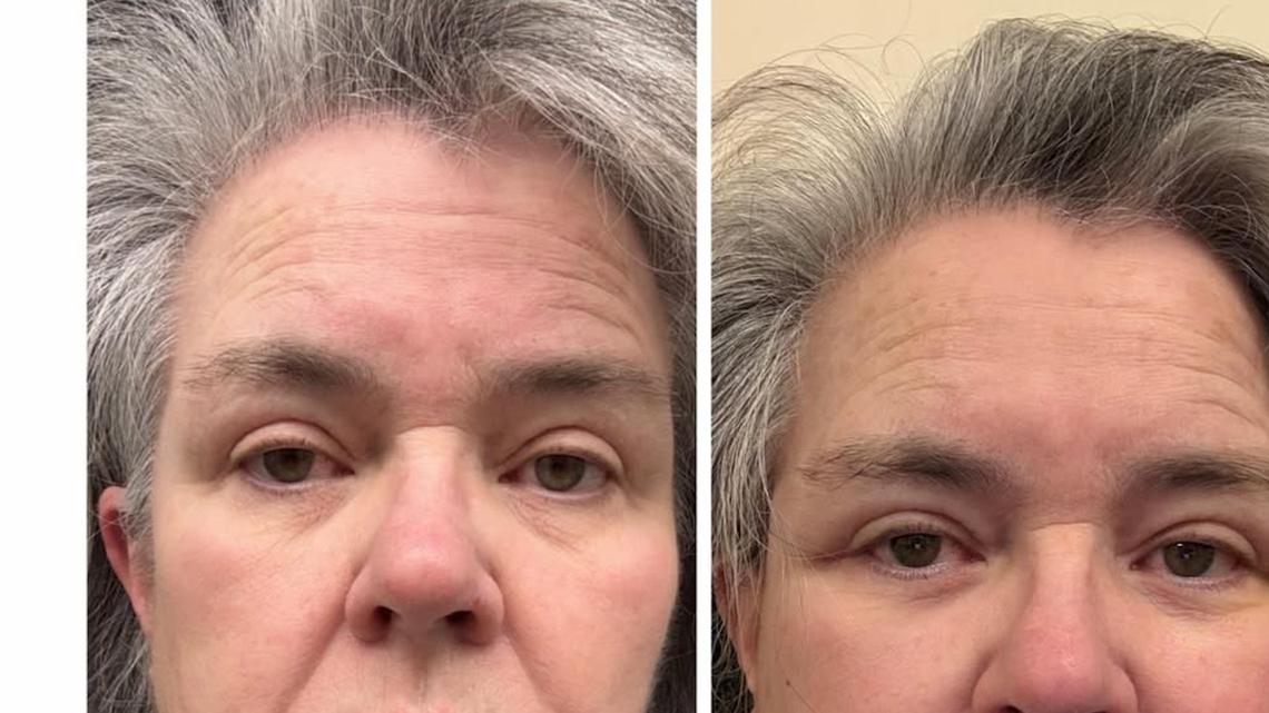 Rosie O'Donnell, 64, Shares Before-And-After Photos of Her Facelift 