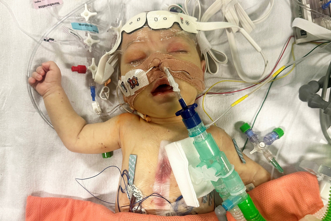  Little Atlas in the hospital. (Tansy Simpson via SWNS) 