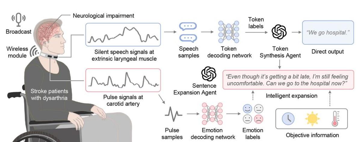  The device works without the need for invasive brain implants. (University of Cambridge via SWNS) 