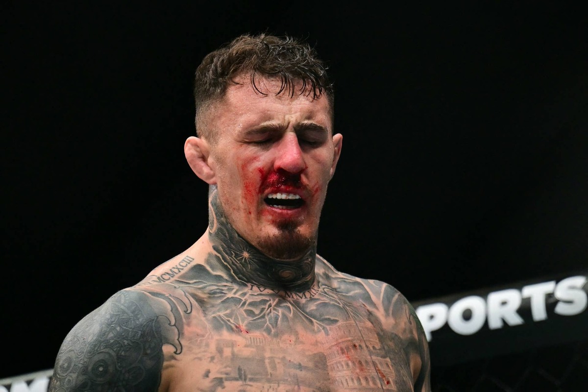  Britain's Tom Aspinall reacts after being hit in the eye while fighting France's Ciryl Gane during their UFC heavyweight title bout at UFC 321 at Etihad Arena in Abu Dhabi early on October 26, 2025. GIUSEPPE CACACE/AFP via Getty Images