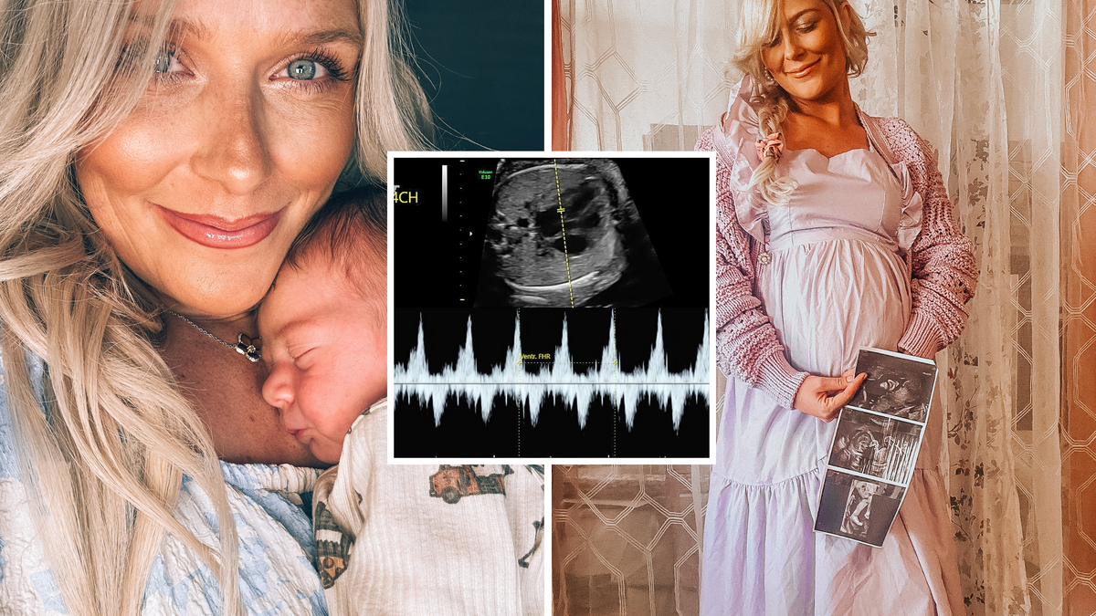 From left: Destiny Paarni holds her baby; inset, a scan before he was born; and Paarni holding the ultrasound scans.