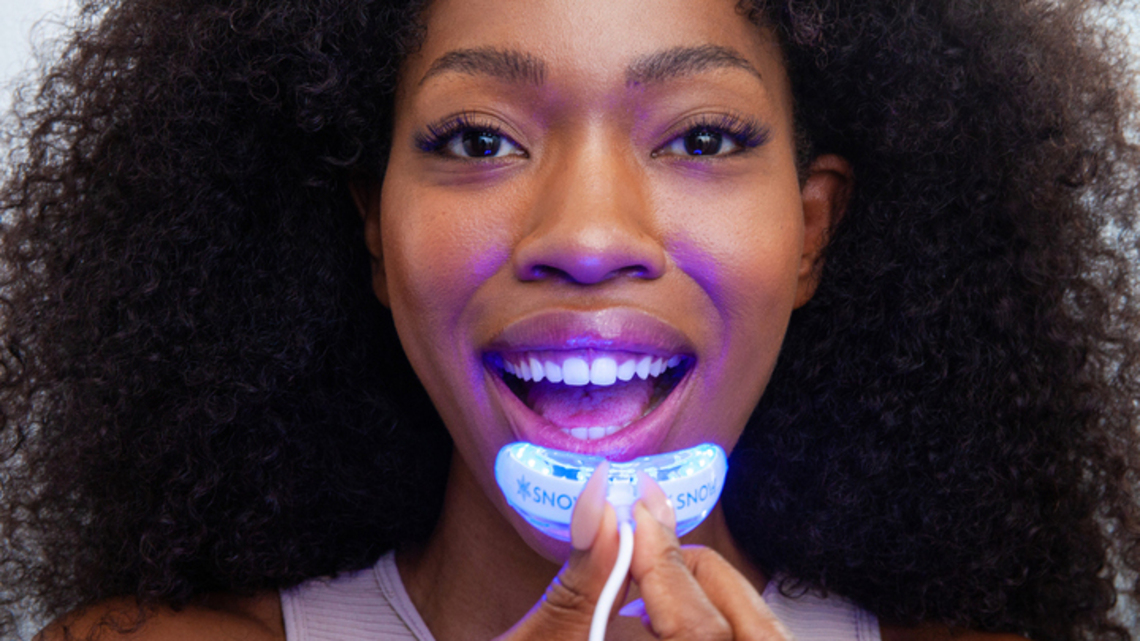 These Teeth-Whitening Kits Give You Professional Results at Home 