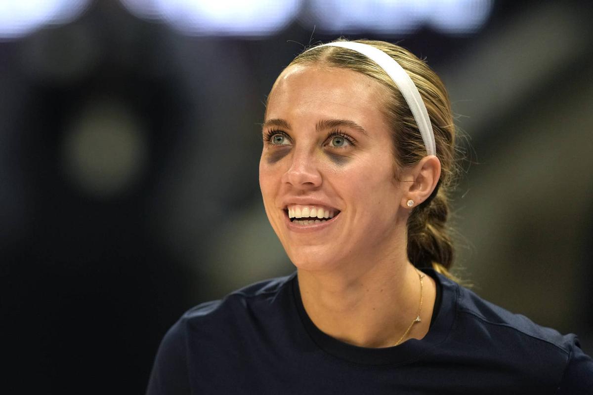  Indiana Fever guard Lexie Hull (10) warms up with two black eyes before a WNBA game. Darren Yamashita-Imagn Images