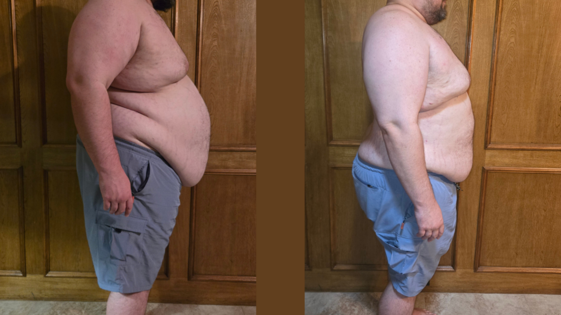 He Was 412 Pounds and Living With Chronic AFib. Here's How One 39-Year-Old Lost 47 Pounds in Two Months 