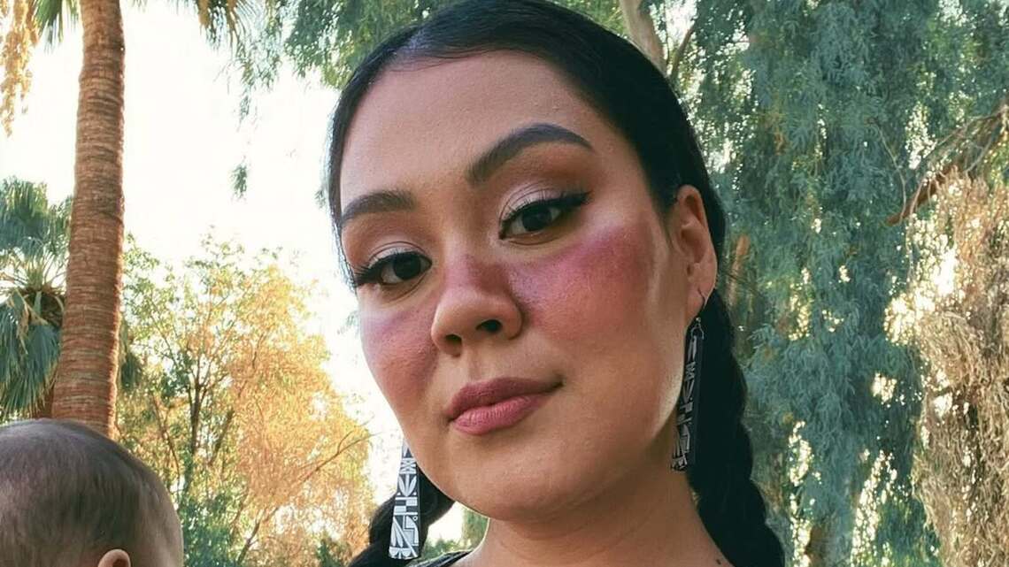 Influencer Siera Amaya Had 'Life-Saving' Surgery After Ectopic Pregnancy 