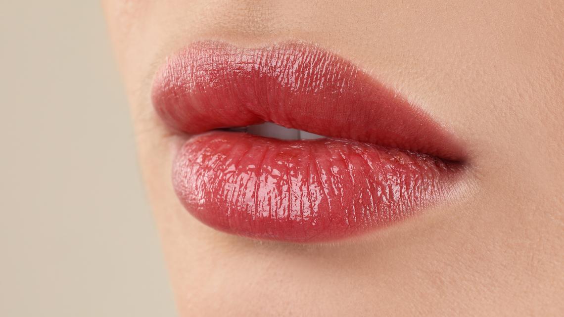 When you age, there is a higher risk of your lips bruising after a filler treatment.