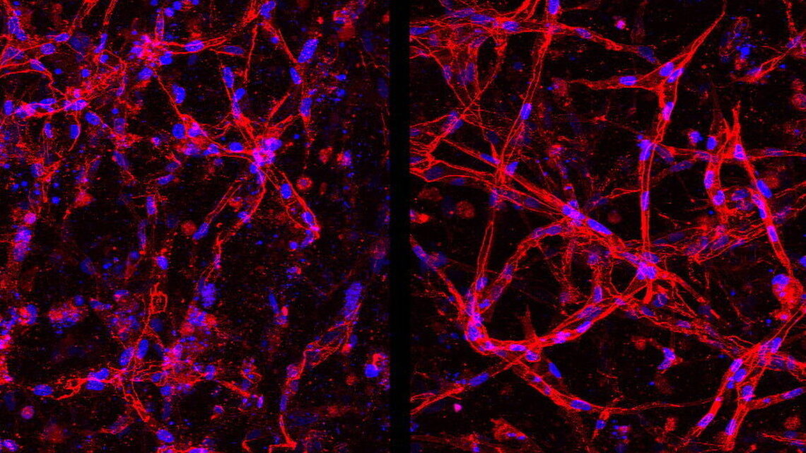 Stem cell breakthrough offers fresh hope for treating blindness