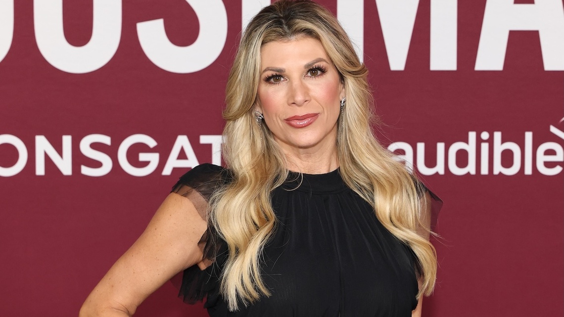 RHOC's Alexis Bellino Reveals Facelift Results, Details 'Brutal' Recovery 