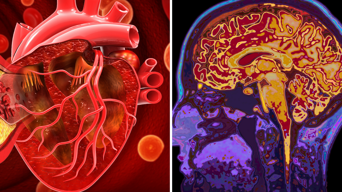 People Without These 3 Risk Factors Lived 13 More Years Without Dementia 