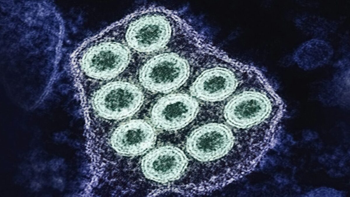 Rabies on the Rise in US: Risks, Symptoms, and Prevention