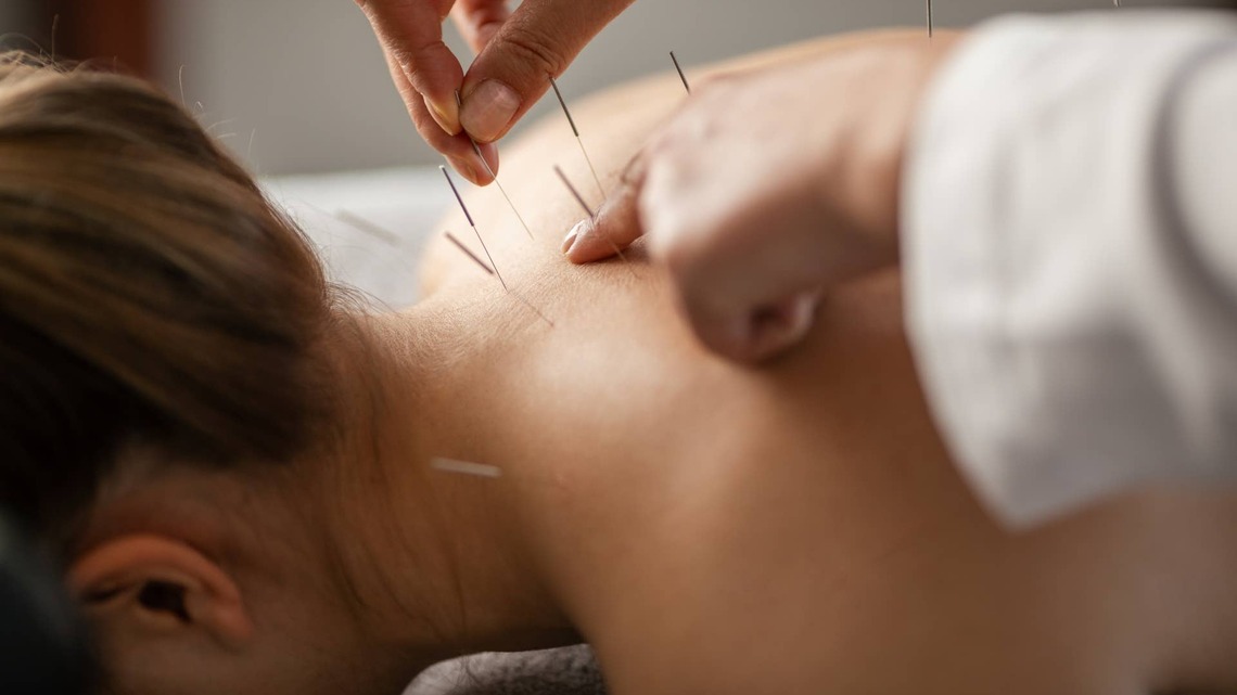 Does Acupuncture Work? What the Needles Actually Treat, What You Can Do at Home, and How to Stay Safe 