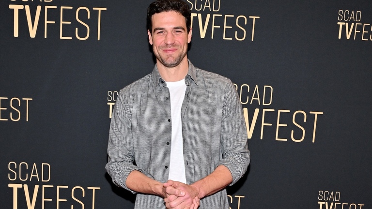 BiP's Joe Amabile Reveals Upcoming Brain Surgery After Finding ‘Lesion' 