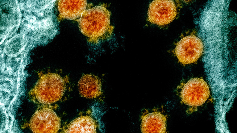 How do COVID infections differ in vaccinated vs. unvaccinated people? What to know
