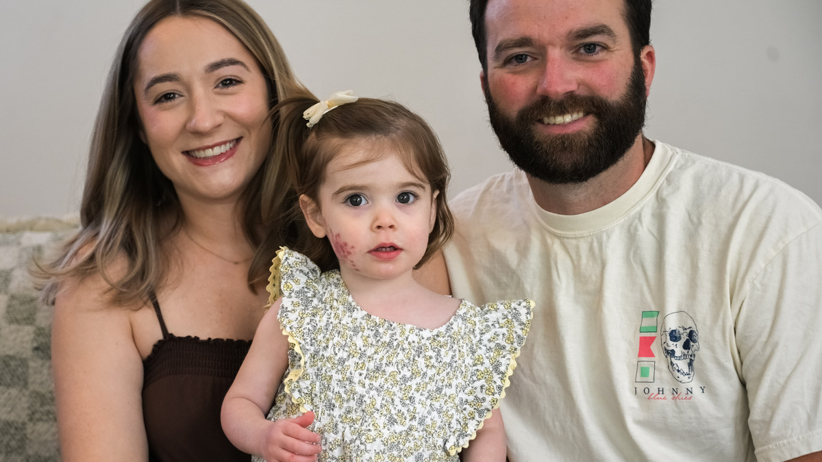 Nicole and Daniel Shaw smile with their daughter, Ivy Shaw, Thursday, June 18, 2026, at the family’s home in Fogelsville. Ivy Shaw was born with a Port Wine Birthmark and has been undergoing laser treatments to remove the birthmark. (Avery Folmar/The Morning Call)