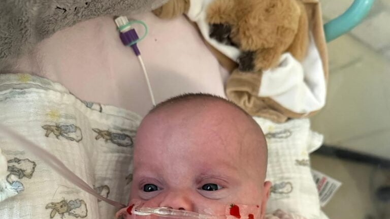 Premature baby undergoes new heart operation