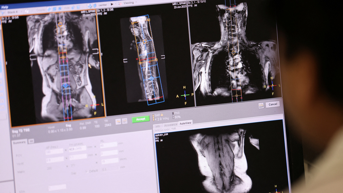 Health Rounds: New dye for MRI exams detects lung cancer earlier