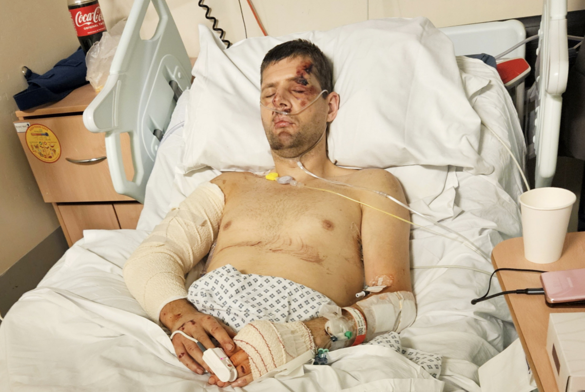  Mike Stubbs in the hospital. (Irwin Mitchell via SWNS) 