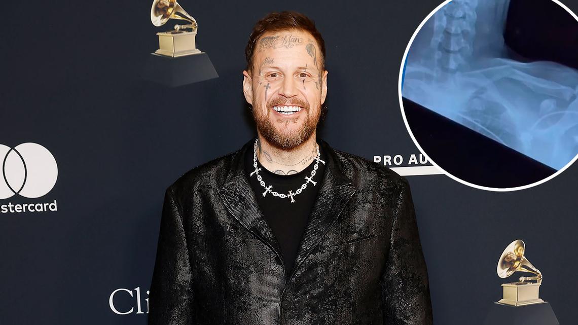Jelly Roll Reveals He Hid an Injury at the 2026 Grammys: 'Wanted to Scream' 