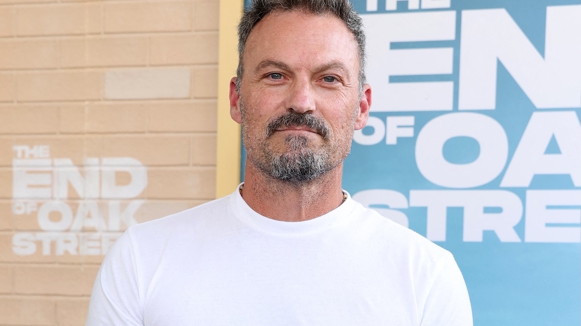 Brian Austin Green Details Neurological Battle With ‘Stroke-Like Symptoms' 