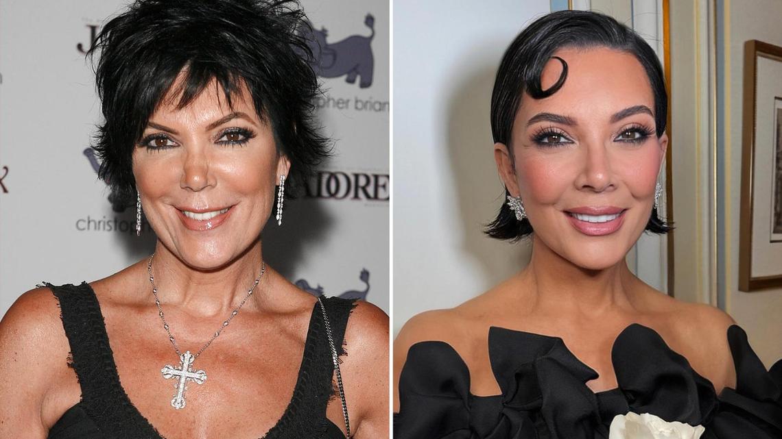 Kris Jenner’s Plastic Surgery Transformation Photos: Her Then and Now Transformation