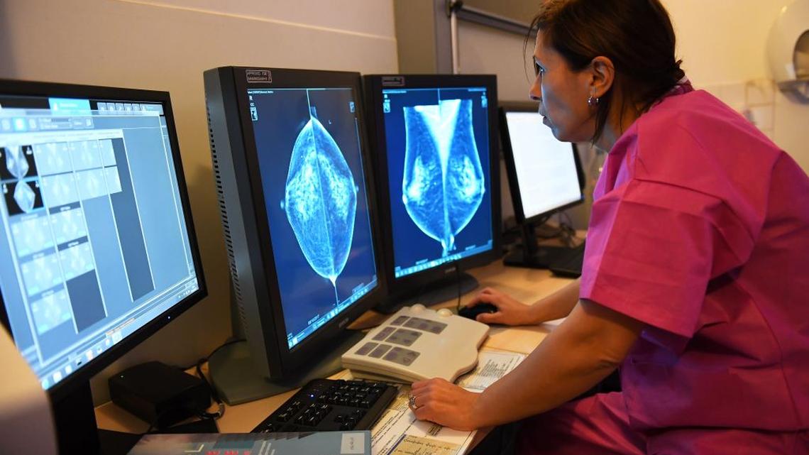 What Women 50+ Need To Know About New Mammogram Guidelines