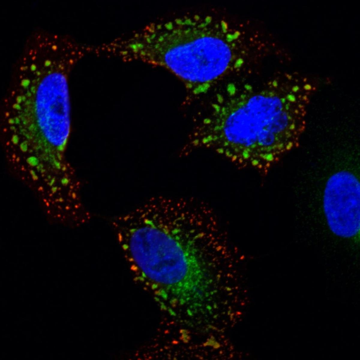  A human lung cell infected with influenza. The viral nucleoprotein is in red, a cellular protein highjacked by influenza is in green, and the cell's nucleus is in blue. (Emily Bruce via SWNS) 