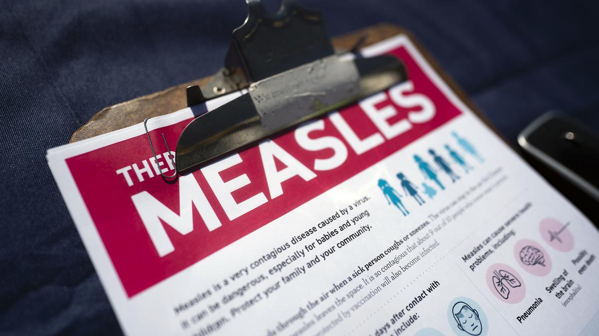 A fact sheet for measles sits on a table at a mobile clinic offering free vaccinations on Feb. 6, 2026, in Spartanburg, South Carolina. (Sean Rayford/Getty Images/TNS)
