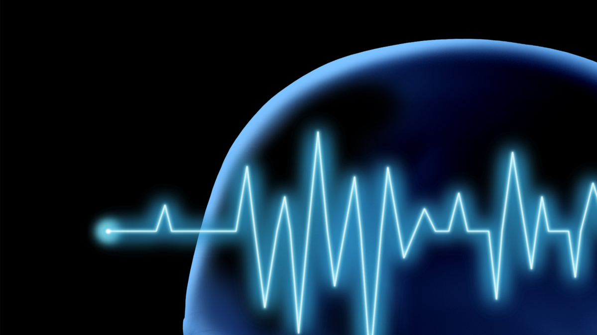 Mayo Clinic experts emphasize that knowing the warning signs of stroke and acting fast can save brain function and lives. (Dreamstime/TNS)