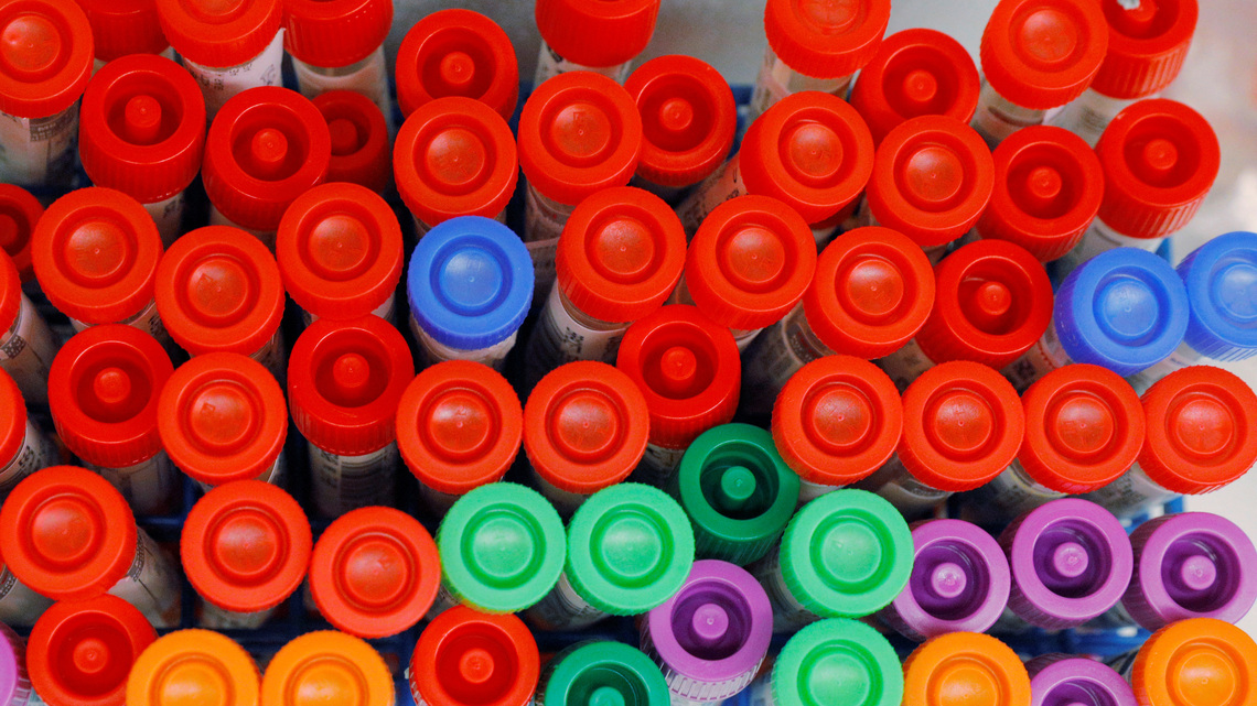 Quest Diagnostics raises annual forecast on testing demand 