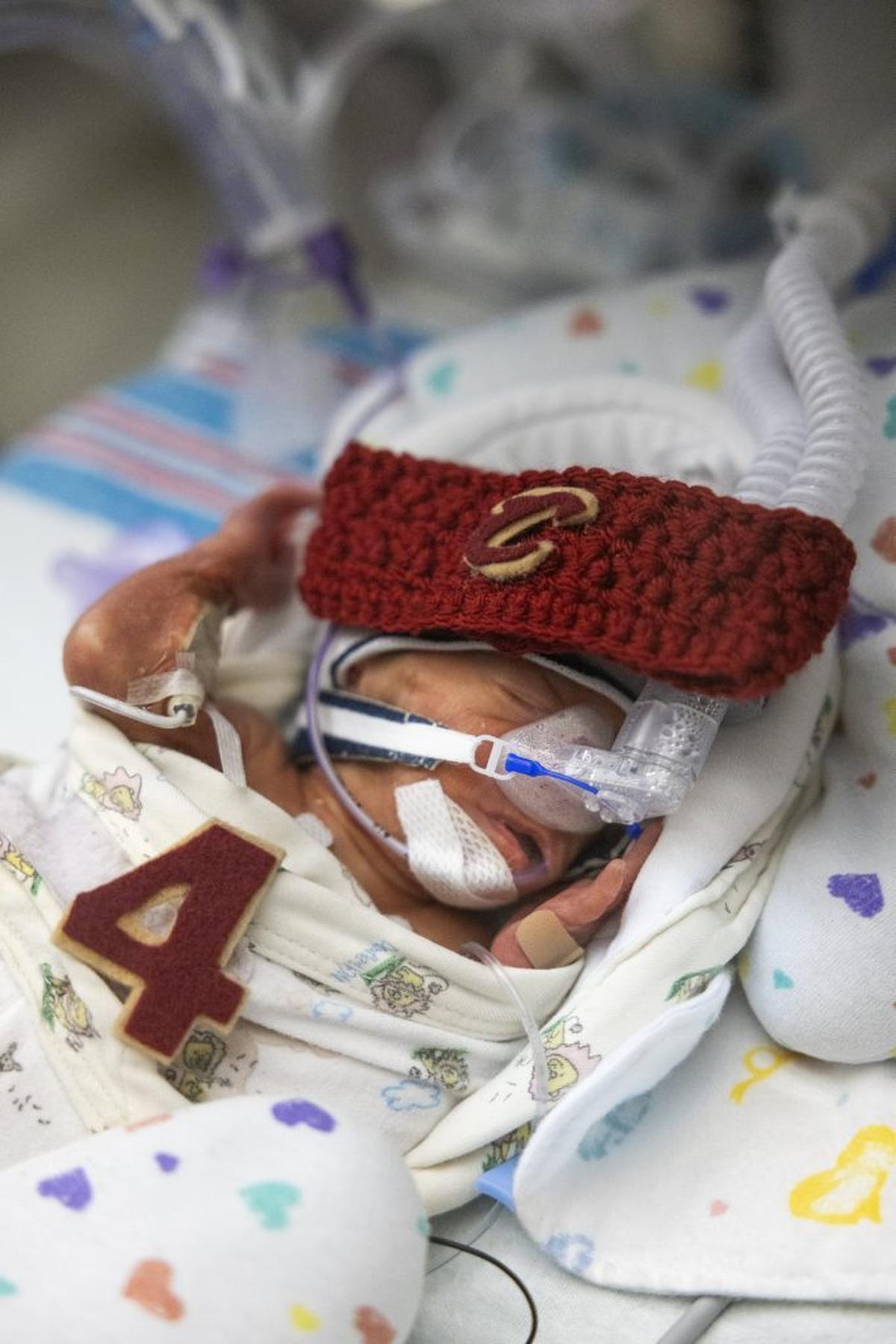  A tiny patient with a headband and Cleveland Cavalier Evan Mobley's No. 4. 