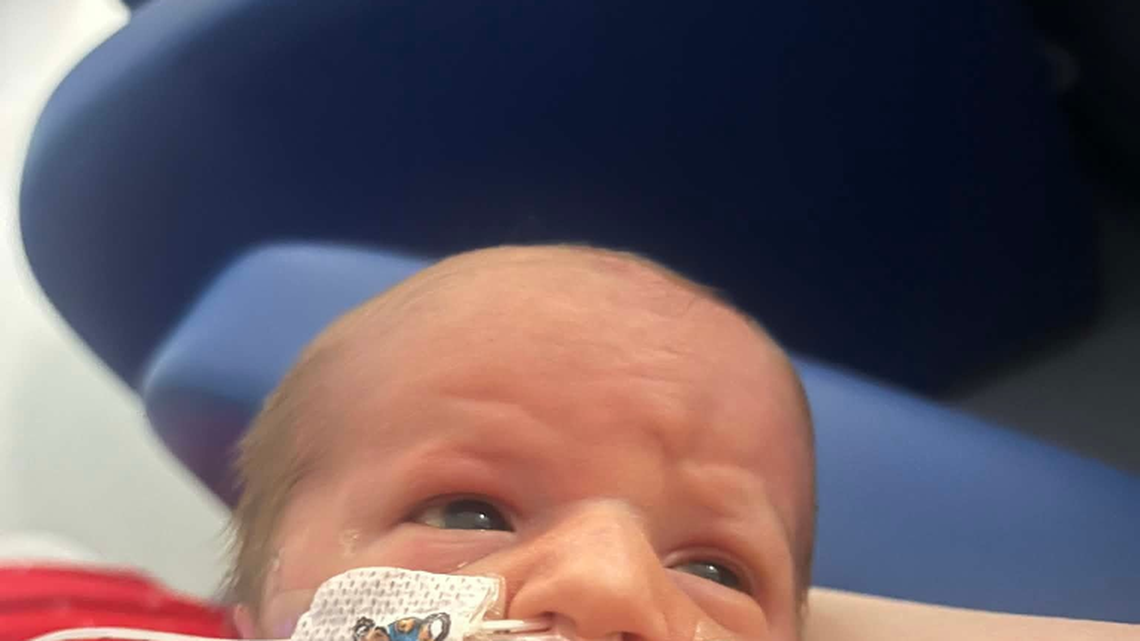 Miracle baby with ultra rare genetic disorder defies odds