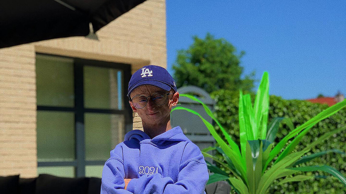 Influencer Michiel Vandeweert With Rare Genetic Disorder Dies at Age 28 