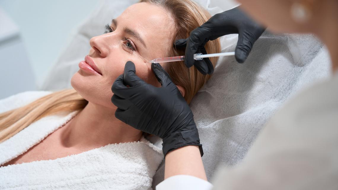 In some cases, facial fillers can migrate from the injection site, resulting in a phenomenon known as ‘pillow face.’