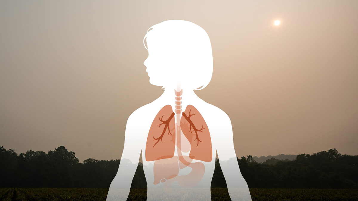 Wildfire smoke is especially harmful to children, with its fine particles potentially causing up to 10 times more damage to developing lungs than other air pollutants.