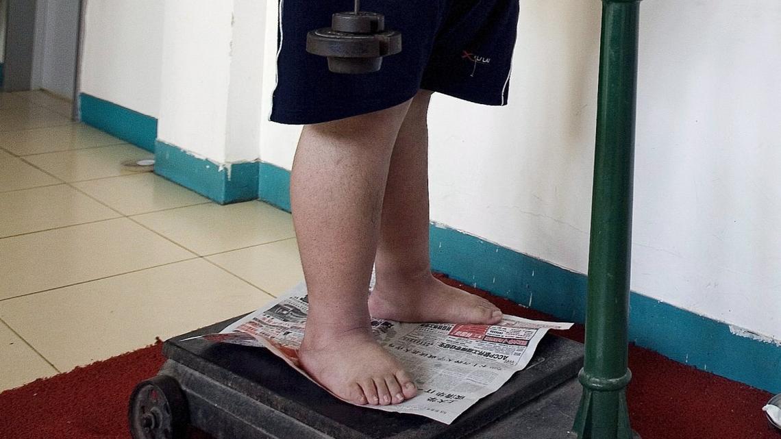 Analysis: Rates of obesity among U.S. adults doubled in 3 decades