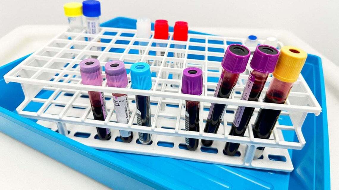 More than 74,000 older adults seek measles immunity tests amid US outbreaks 